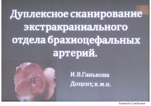 Дуплексное сканирование экстракраниального отдела брахиоцефальных артерий