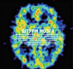 Штурм мозга